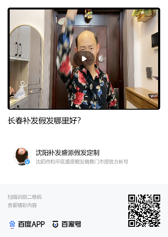 长春补发假发哪里好，长春盛源很专业